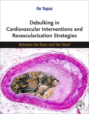 Debulking in Cardiovascular Interventions and Revascularization Strategies: Between a Rock and the Heart