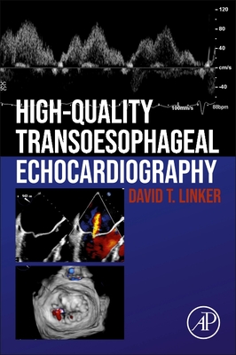 High-Quality Transesophageal Echocardiography