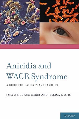 Aniridia and WAGR Syndrome