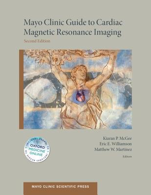 Mayo Clinic Guide to Cardiac Magnetic Resonance Imaging (Revised)