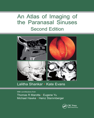 An Atlas of Imaging of the Paranasal Sinuses