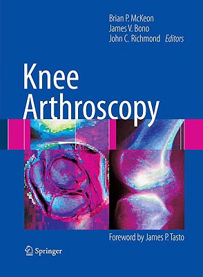 Knee Arthroscopy