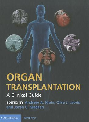 Organ Transplantation: A Clinical Guide