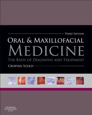 Oral and Maxillofacial Medicine: The Basis of Diagnosis and Treatment