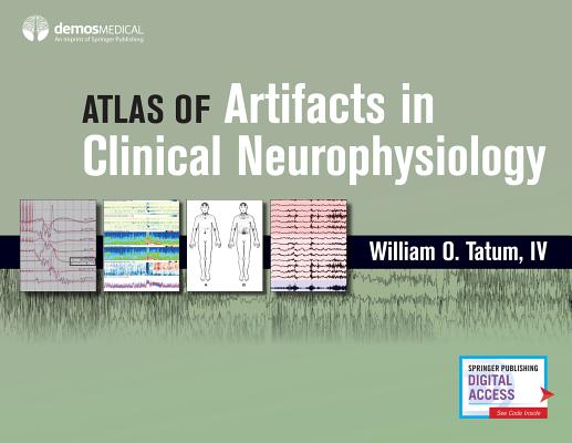 Atlas of Artifacts in Clinical Neurophysiology