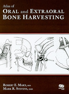 Atlas of Oral and Extraoral Bone Harvesting