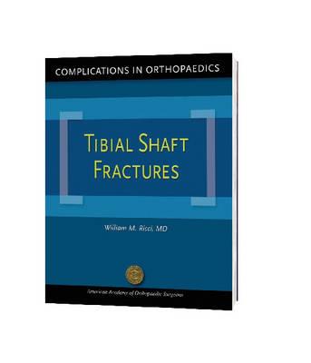 Complications in Orthopaedics: Tibial Shaft Fractures