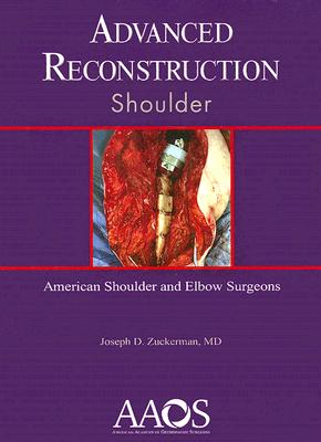 Advanced Reconstruction: Shoulder