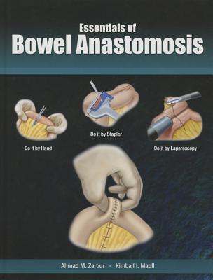 Essentials of Bowel Anastomosis