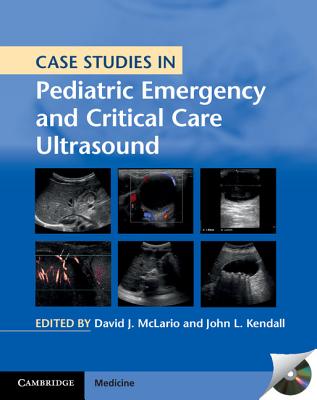 Case Studies in Pediatric Emergency and Critical Care Ultrasound with DVD-ROM