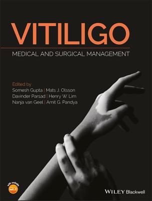 Vitiligo: Medical and Surgical Management