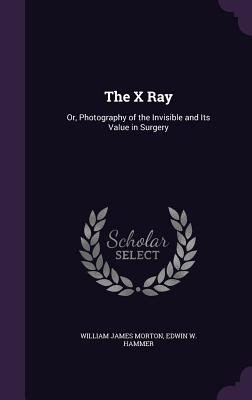 The X Ray: Or, Photography of the Invisible and Its Value in Surgery