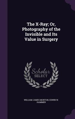 The X-Ray; Or, Photography of the Invisible and Its Value in Surgery