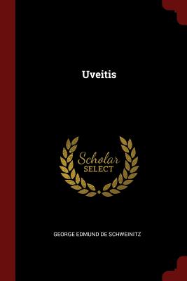 Uveitis