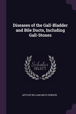 Diseases of the Gall-Bladder and Bile Ducts, Including Gall-Stones