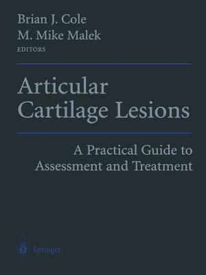 Articular Cartilage Lesions: A Practical Guide to Assessment and Treatment