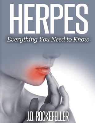 Herpes: Everything You Need to Know