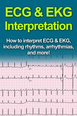 ECG & EKG Interpretation: How to interpret ECG & EKG, including rhythms, arrhythmias, and more!