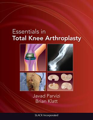 Essentials in Total Knee Arthroplasty