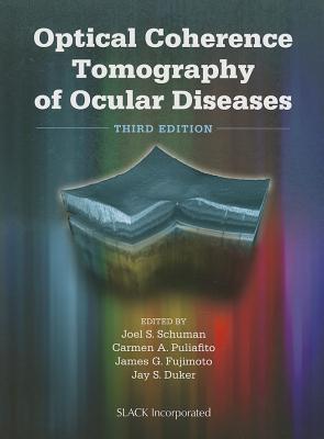 Optical Coherence Tomography of Ocular Diseases