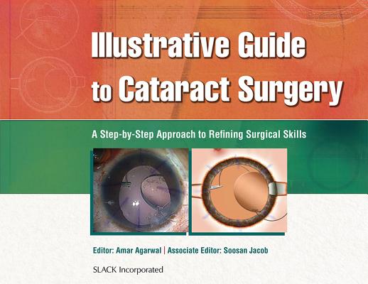 Illustrative Guide to Cataract Surgery: A Step-By-Step Approach to Refining Surgical Skills