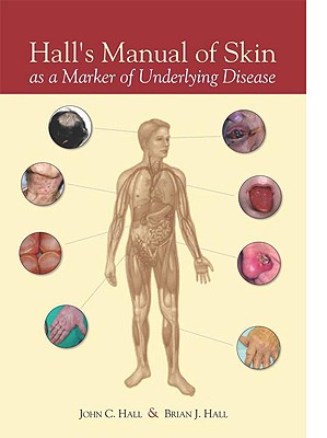 Hall's Manual of Skin as a Marker of Underlying Disease