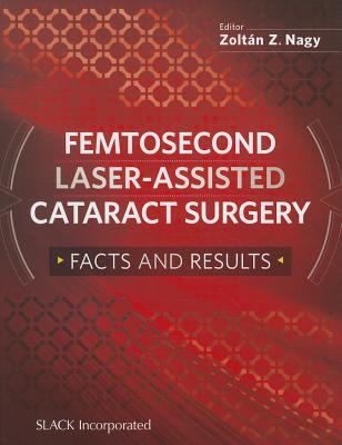Femtosecond Laser-Assisted Cataract Surgery: Facts and Results