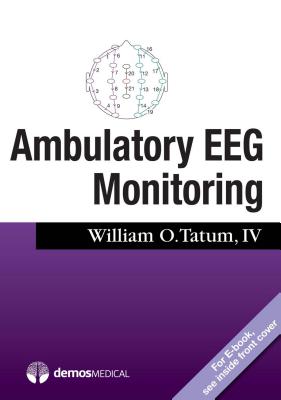 Ambulatory Eeg Monitoring