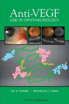 Anti-Vegf Use in Ophthalmology