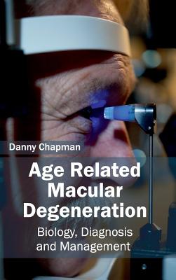 Age Related Macular Degeneration: Biology, Diagnosis and Management