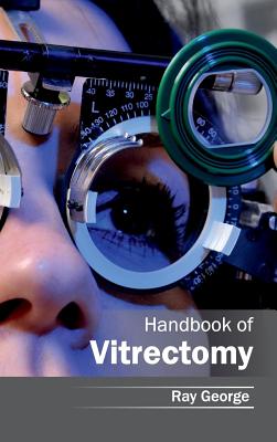 Handbook of Vitrectomy