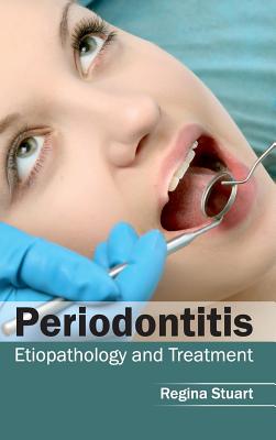 Periodontitis: Etiopathology and Treatment