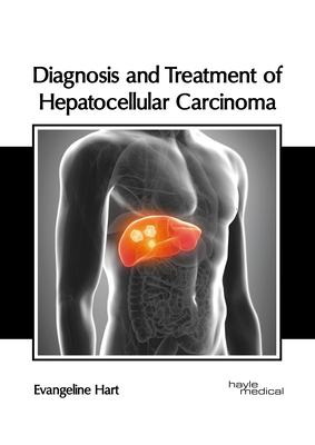 Diagnosis and Treatment of Hepatocellular Carcinoma