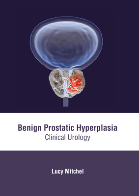 Benign Prostatic Hyperplasia: Clinical Urology
