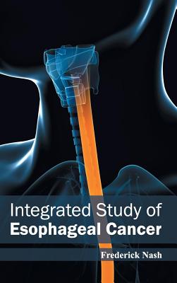 Integrated Study of Esophageal Cancer