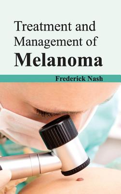 Treatment and Management of Melanoma