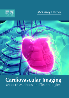Cardiovascular Imaging: Modern Methods and Technologies
