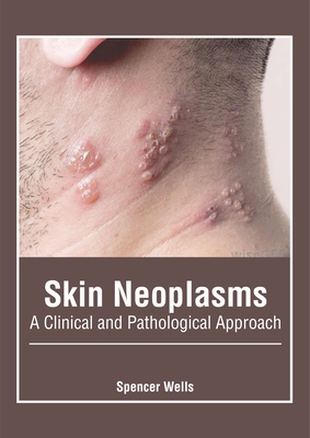 Skin Neoplasms: A Clinical and Pathological Approach