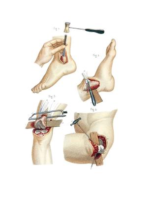 Resections Performed on the Lower Extremity Composition Notebook: Wide Ruled Note-Taking Book