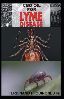 CBD Oil for Lyme Disease: All You Need to Know about Using CBD Oil to Treat Lyme Disease