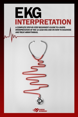 Ekg Interpretation: A complete step-by-step beginner's guide to a rapid interpretation of the 12-lead EKG and on how to diagnose and treat arrhythmias.
