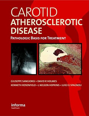 Carotid Atherosclerotic Disease: Pathologic Basis for Treatment