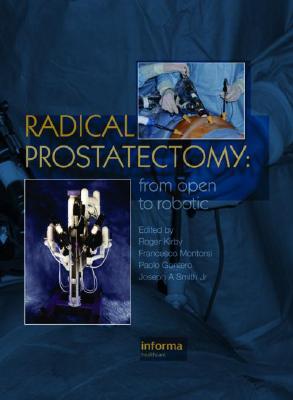 Radical Prostatectomy: From Open to Robotic