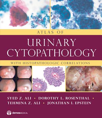 Atlas of Urinary Cytopathology: With Histopathologic Correlations