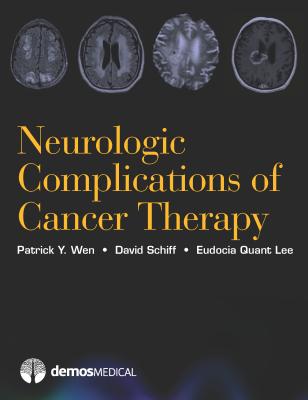 Neurologic Complications of Cancer Therapy