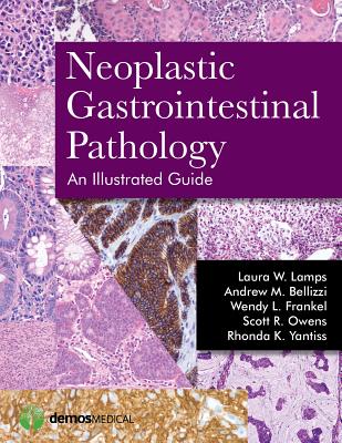 Neoplastic Gastrointestinal Pathology: An Illustrated Guide: An Illustrated Guide