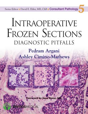 Intraoperative Frozen Sections: Diagnostic Pitfalls