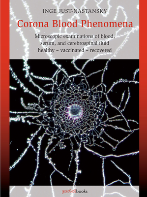 Corona Blood Phenomena: Microscopic Examinations of Blood, Serum, and Cerebrospinal Fluid: Healthy - Vaccinated - Recovered