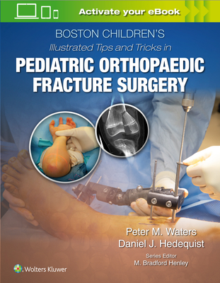 Boston Children's Illustrated Tips and Tricks in Pediatric Orthopaedic Fracture Surgery