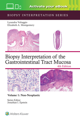 Biopsy Interpretation of the Gastrointestinal Tract Mucosa Volume 1: Non-Neoplastic: Print + eBook with Multimedia Volume 1